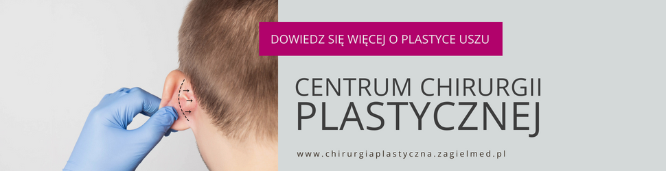 operacja plastyczna odstających małżowin usznych, Centrum Chirurgii Plastycznej Żagiel Med w Lublinie